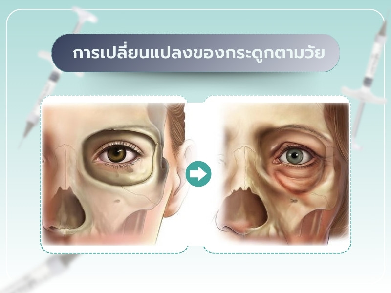 การเปลี่ยนแปลงของกระดูกตามวัย