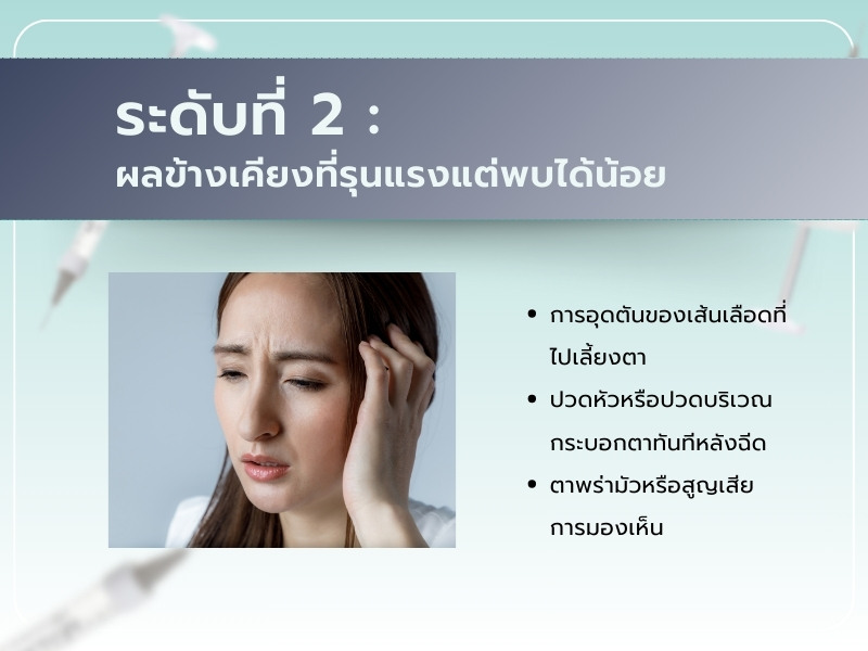 ผลข้างเคียงการฉีดฟิลเลอร์ขมับ ระดับที่ 2