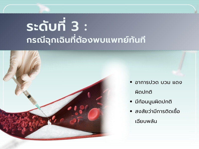 ผลข้างเคียงการฉีดฟิลเลอร์ขมับ ระดับที่ 3