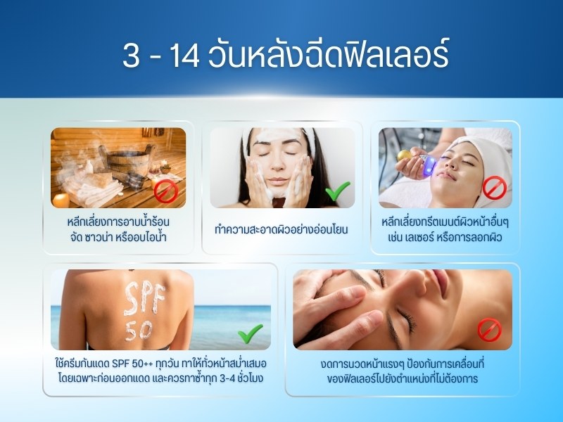 3 - 14 วันหลังฉีดฟิลเลอร์