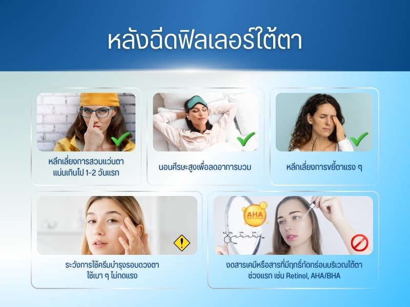 หลังฉีดฟิลเลอร์ใต้ตา