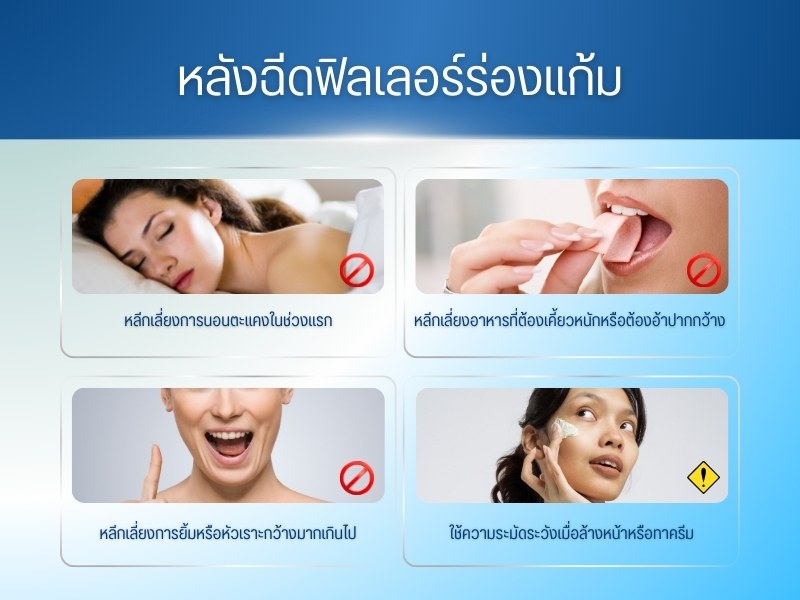 หลังฉีดฟิลเลอร์ร่องแก้ม