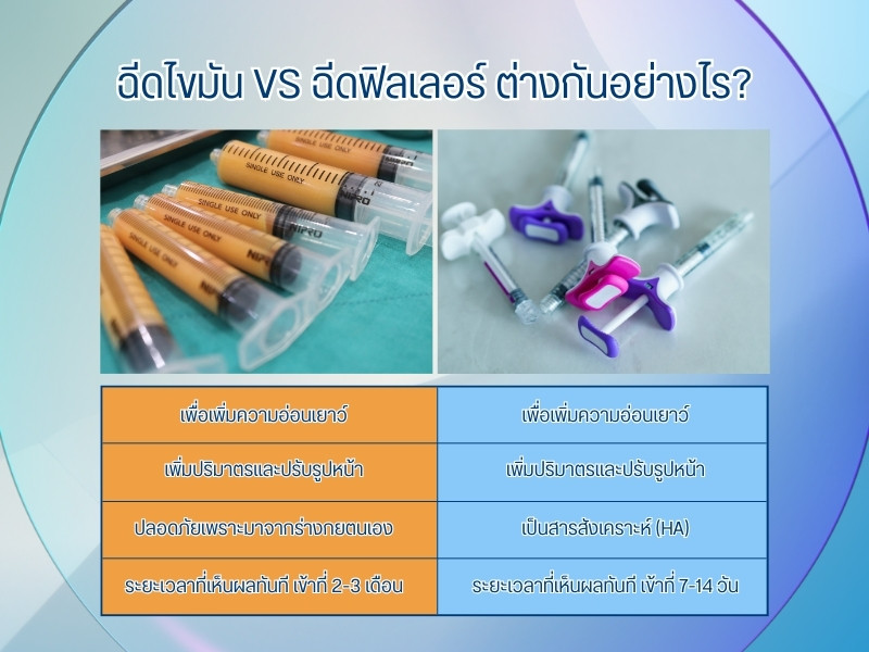 เทียบแต่ละด้าน ฉีดไขมันกับฉีดฟิลเลอร์