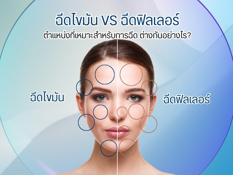 ตำแหน่งที่เหมาะสำหรับฉีด ฉีดไขมันกับฉีดฟิลเลอร์