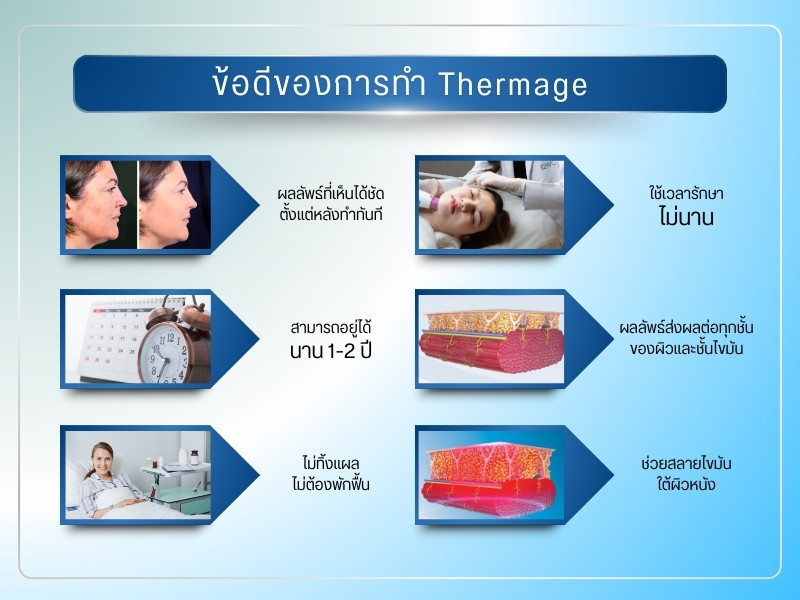 ข้อดีการทำ Thermage