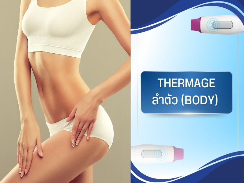 Thermage ลำตัว (Body)