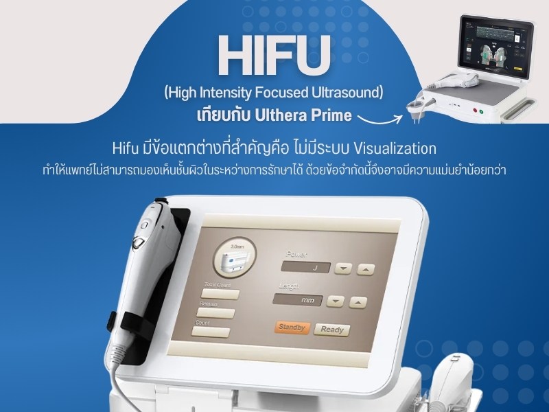 HIFU (High Intensity Focused Ultrasound)