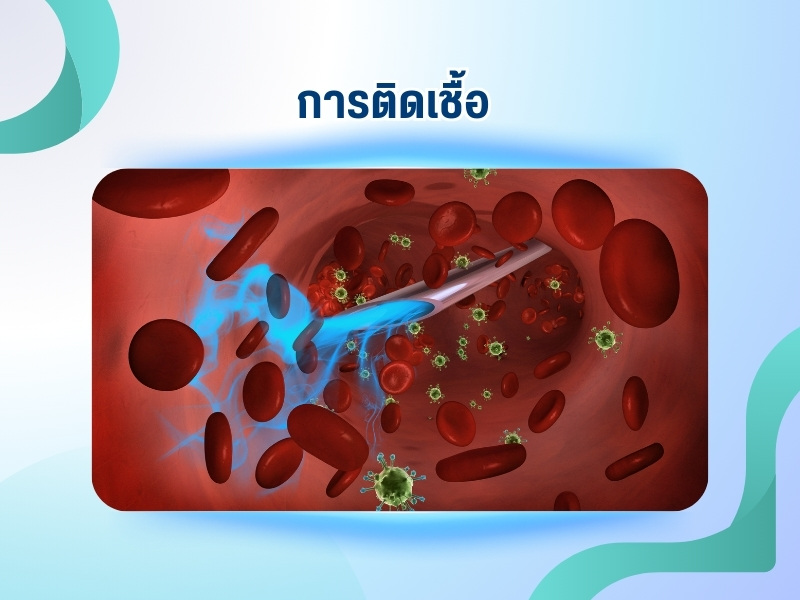 การติดเชื้อ