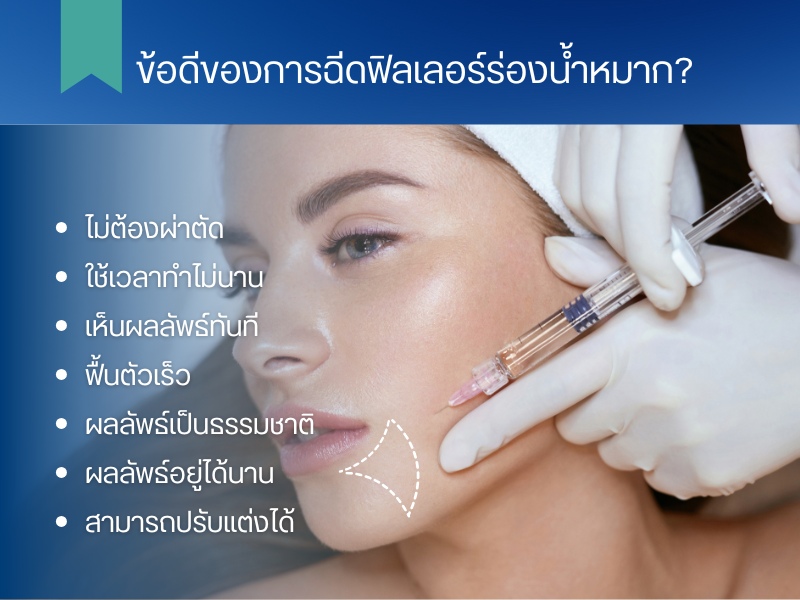 ร่องน้ำหมาก คืออะไร