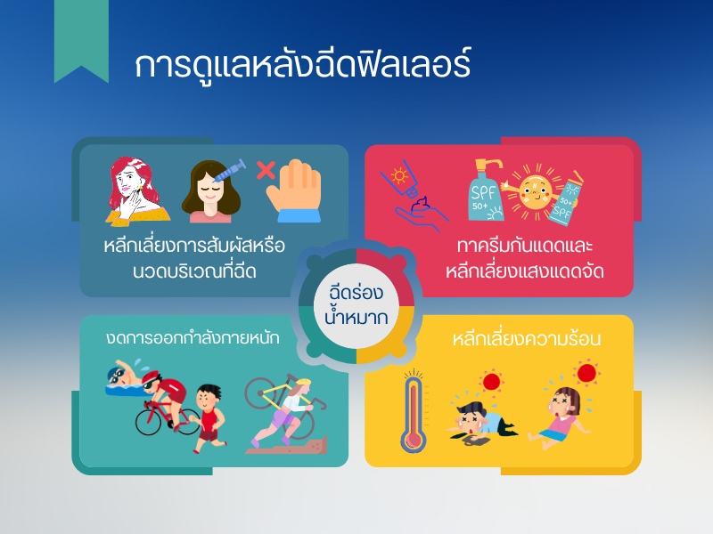 ขั้นตอนการฉีดฟิลเลอร์ร่องน้ำหมาก