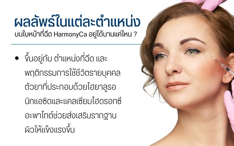 ผลลัพธ์ในแต่ละตำแหน่งบนใบหน้าที่ฉีด HarmonyCa อยู่ได้นานแค่ไหน ?
