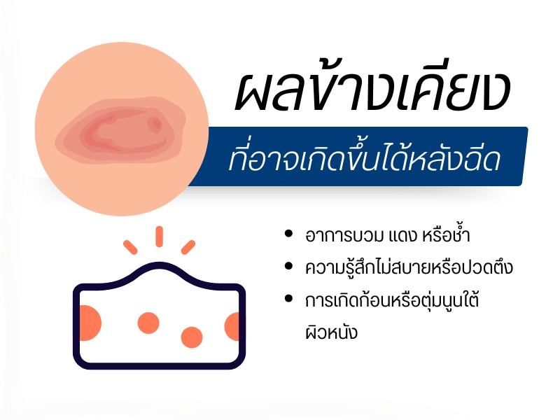 ผลข้างเคียงที่อาจเกิดขึ้นได้หลังฉีด