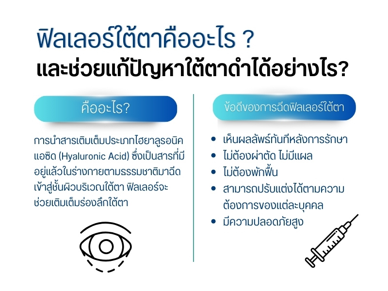 ฟิลเลอร์ใต้ตาคืออะไร และช่วยแก้ปัญหาใต้ตาดำได้อย่างไร