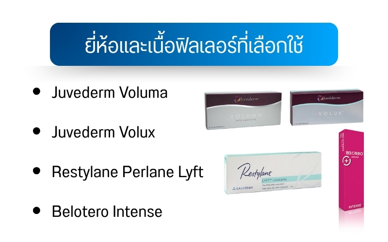 ยี่ห้อและเนื้อฟิลเลอร์ที่เลือกใช้