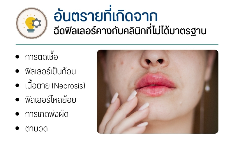 อันตรายที่เกิดจากฉีดฟิลเลอร์คางกับคลินิกที่ไม่ได้มาตรฐาน