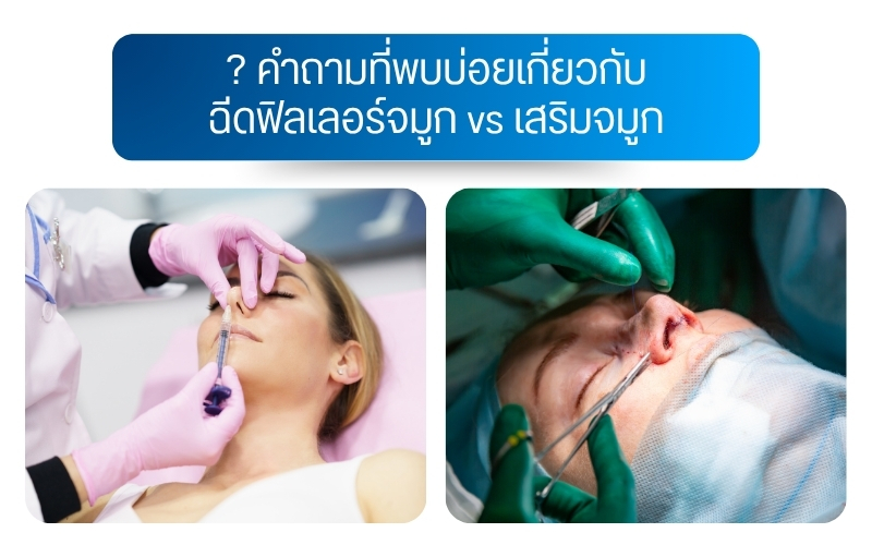 คำถามที่พบบ่อยเกี่ยวกับ ฉีดฟิลเลอร์จมูก vs เสริมจมูก