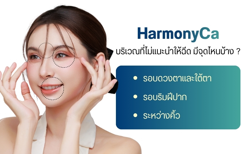 บริเวณที่ไม่แนะนำให้ฉีด HarmonyCa มีจุดไหนบ้าง ?