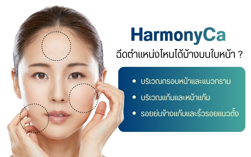 HarmonyCa ฉีดตำแหน่งไหนได้บ้างบนใบหน้า ?