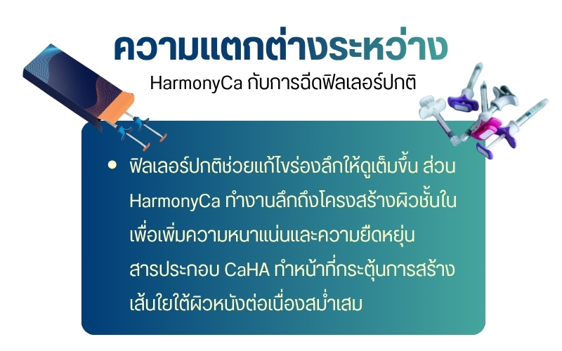 ความแตกต่างระหว่าง HarmonyCa กับการฉีดฟิลเลอร์ปกติ