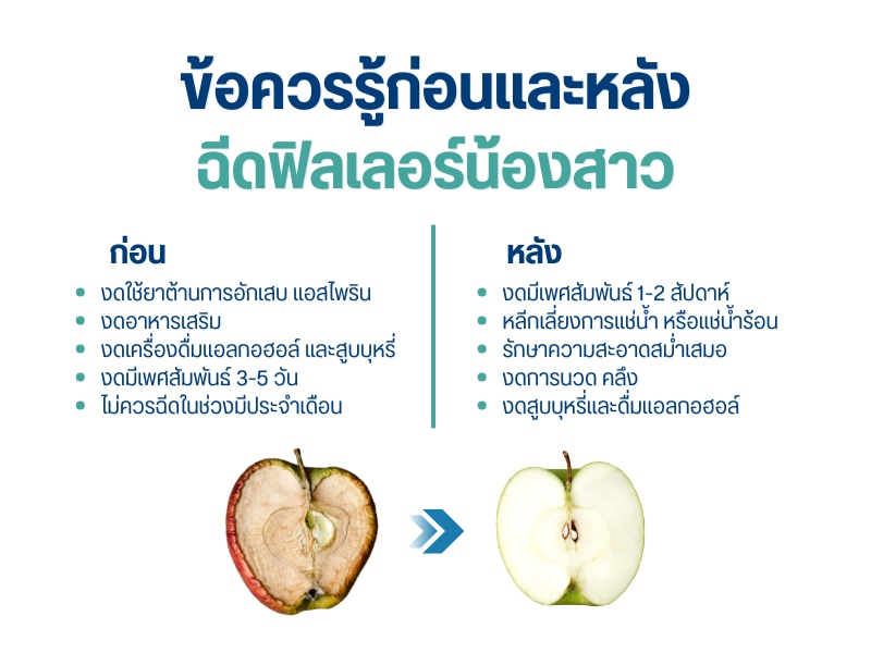 ข้อควรรู้ก่อนและหลังฉีดฟิลเลอร์น้องสาว