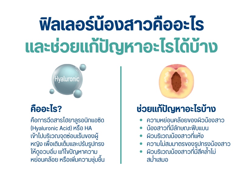 ฟิลเลอร์น้องสาวคืออะไร และช่วยแก้ปัญหาอะไรได้บ้าง