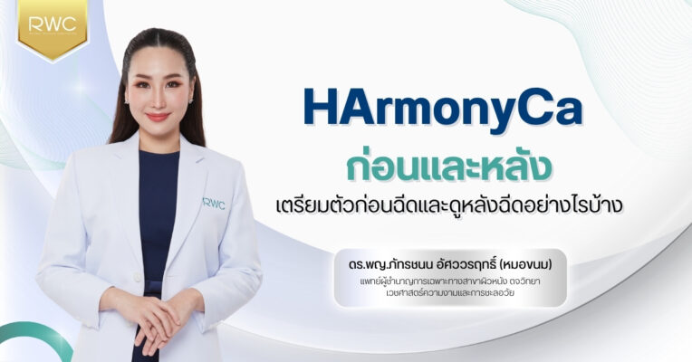 HArmonyCa ก่อนและหลัง | เตรียมตัวก่อนฉีดและดูหลังฉีดอย่างไรบ้าง