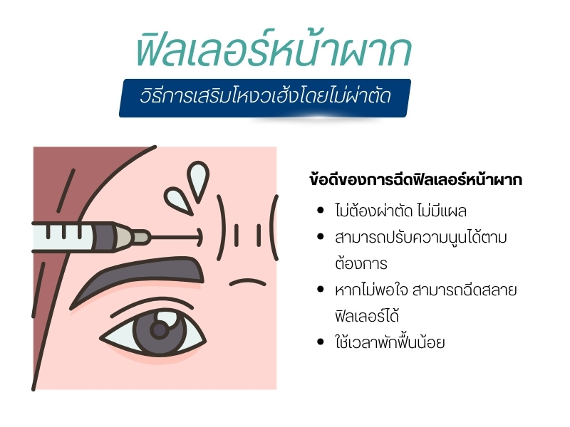 ฟิลเลอร์หน้าผาก: วิธีการเสริมโหงวเฮ้งโดยไม่ผ่าตัด