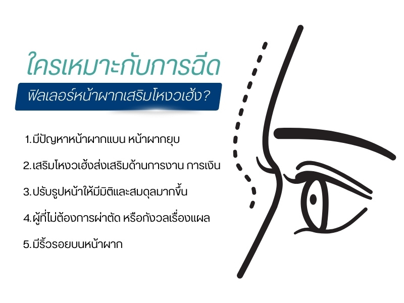 ใครเหมาะกับการฉีดฟิลเลอร์หน้าผากเสริมโหงวเฮ้ง?