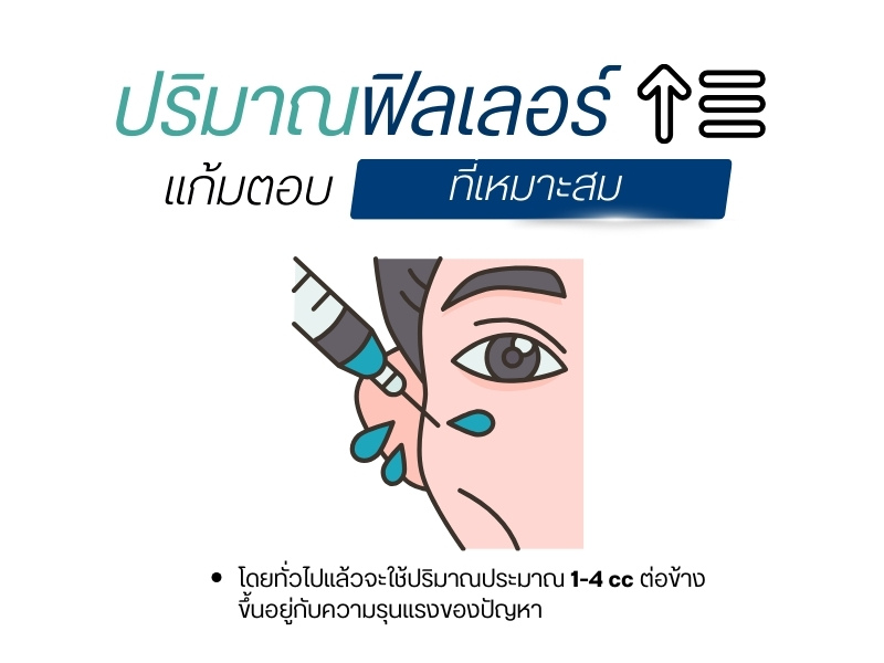 ปริมาณฟิลเลอร์แก้มตอบที่เหมาะสม