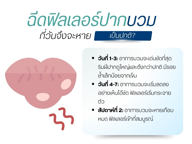 ฉีดฟิลเลอร์ปากบวมกี่วัน จึงจะหายเป็นปกติ?
