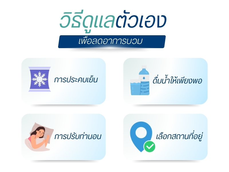 วิธีดูแลตัวเองเพื่อลดอาการบวม