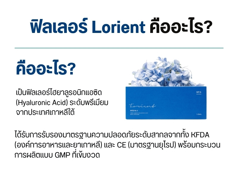 ฟิลเลอร์ Lorient คืออะไร?