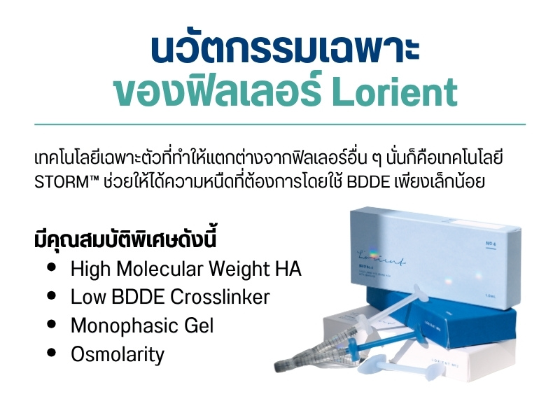 นวัตกรรมเฉพาะของฟิลเลอร์ Lorient