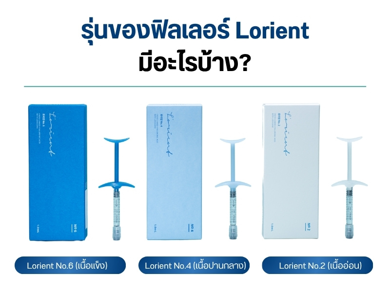 รุ่นของฟิลเลอร์ Lorient มีอะไรบ้าง