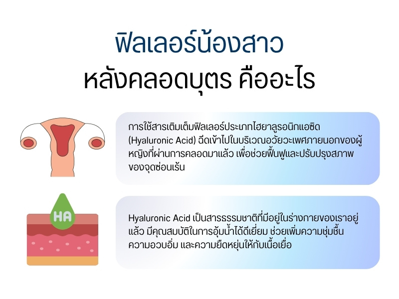 ฟิลเลอร์น้องสาว หลังคลอดบุตร คืออะไร