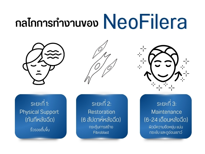 กลไกการทำงานของ NeoFilera