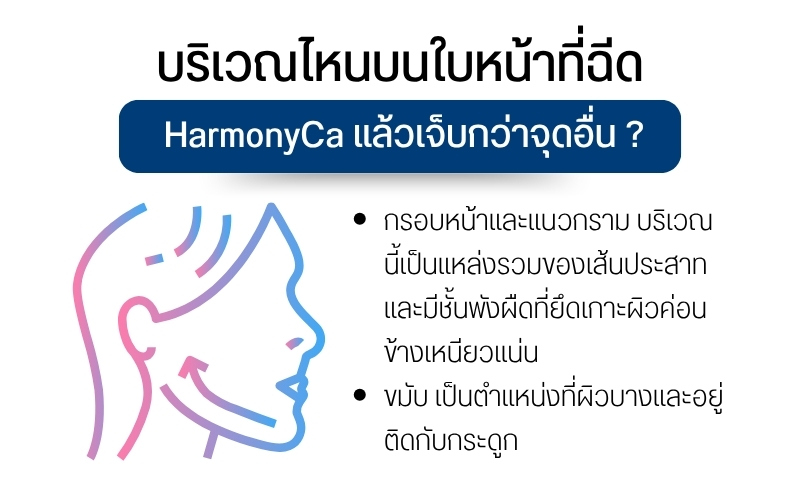 บริเวณไหนบนใบหน้าที่ฉีด HarmonyCa แล้วเจ็บกว่าจุดอื่น ?