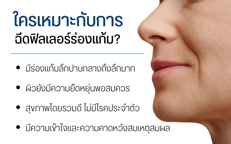 ใครเหมาะกับการฉีดฟิลเลอร์ร่องแก้ม?