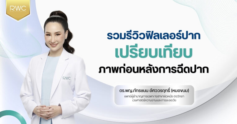 รวม รีวิวฟิลเลอร์ปาก เปรียบเทียบภาพก่อนหลังการฉีดปาก
