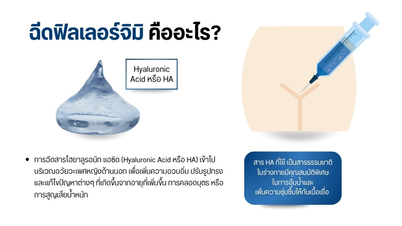 ฉีดฟิลเลอร์จิมิ คืออะไร