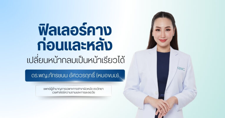 ฟิลเลอร์คางก่อนและหลัง