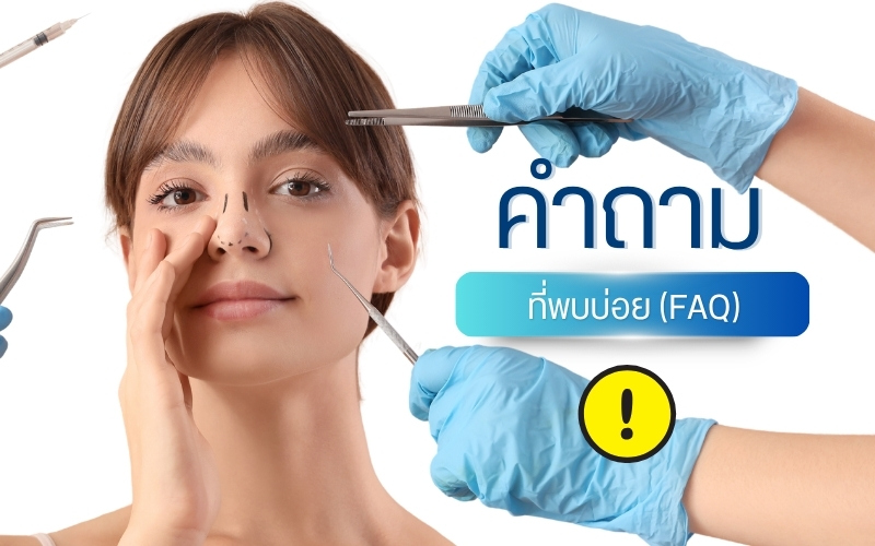 คำถามที่พบบ่อย (FAQ)