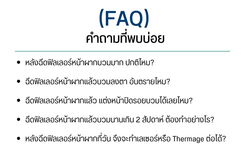 คำถามที่พบบ่อย (FAQ)