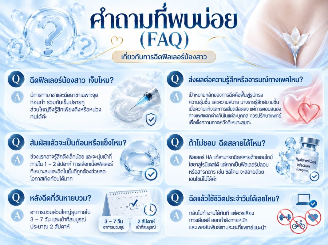 คำถามที่พบบ่อย (FAQ)