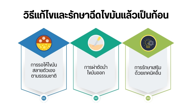 วิธีแก้ไขและรักษาฉีดไขมันแล้วเป็นก้อน