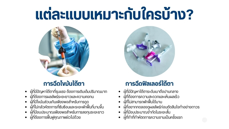 เลือกอะไรดีระหว่าง ฉีดไขมันใต้ตา VS ฉีดฟิลเลอร์ใต้ตา