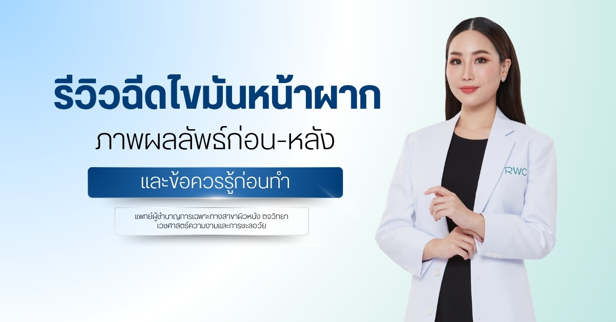 รีวิวฉีดไขมันหน้าผาก