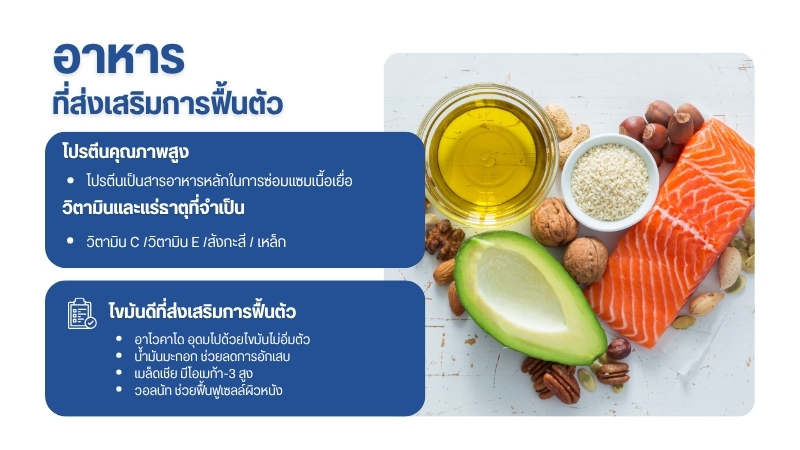 อาหารที่ส่งเสริมการฟื้นตัว