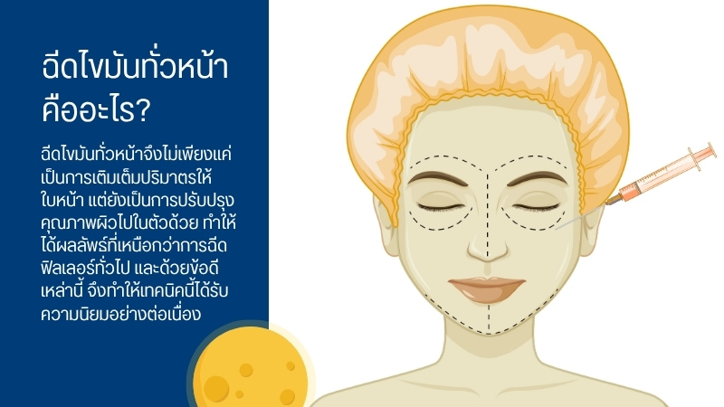 ฉีดไขมันทั่วหน้า คืออะไร?