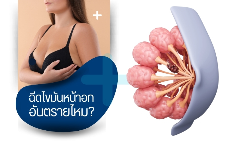 ฉีดไขมันหน้าอกอันตรายไหม?